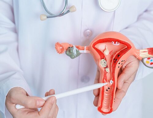 La ricerca italiana scopre un nuovo modo per fare diagnosi precoce del tumore ovarico